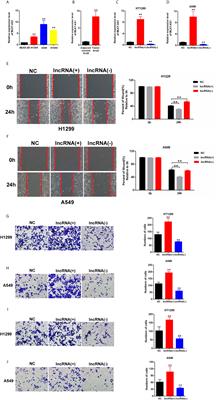 Long Noncoding RNA MLK7-AS1 Promotes Non-Small-Cell Lung Cancer Migration and Invasion via the miR-375-3p/YWHAZ Axis